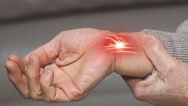 Hội chứng ống cổ tay 