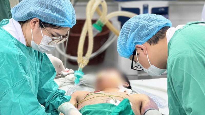 Thủy đậu ở người trẻ khỏe: Biến chứng nguy kịch, cảnh báo không được chủ quan