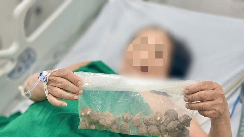 Sốc tim nguy kịch do dùng quá liều củ ấu tẩu