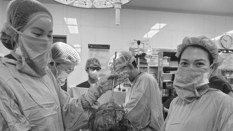 Bảo tồn tử cung thành công cho bệnh nhân có khối u xơ hơn 30cm