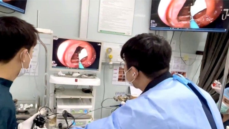 Thường xuyên ăn đồ tái, người đàn ông phát hiện nhiễm sán dây dài gần 80cm trong đại tràng