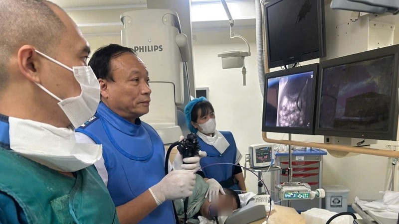 Đau bụng, vàng da tưởng rối loạn tiêu hóa, phát hiện tắc mật nặng do sỏi ống mật chủ